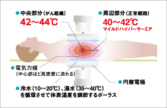 どうやって加温するの？